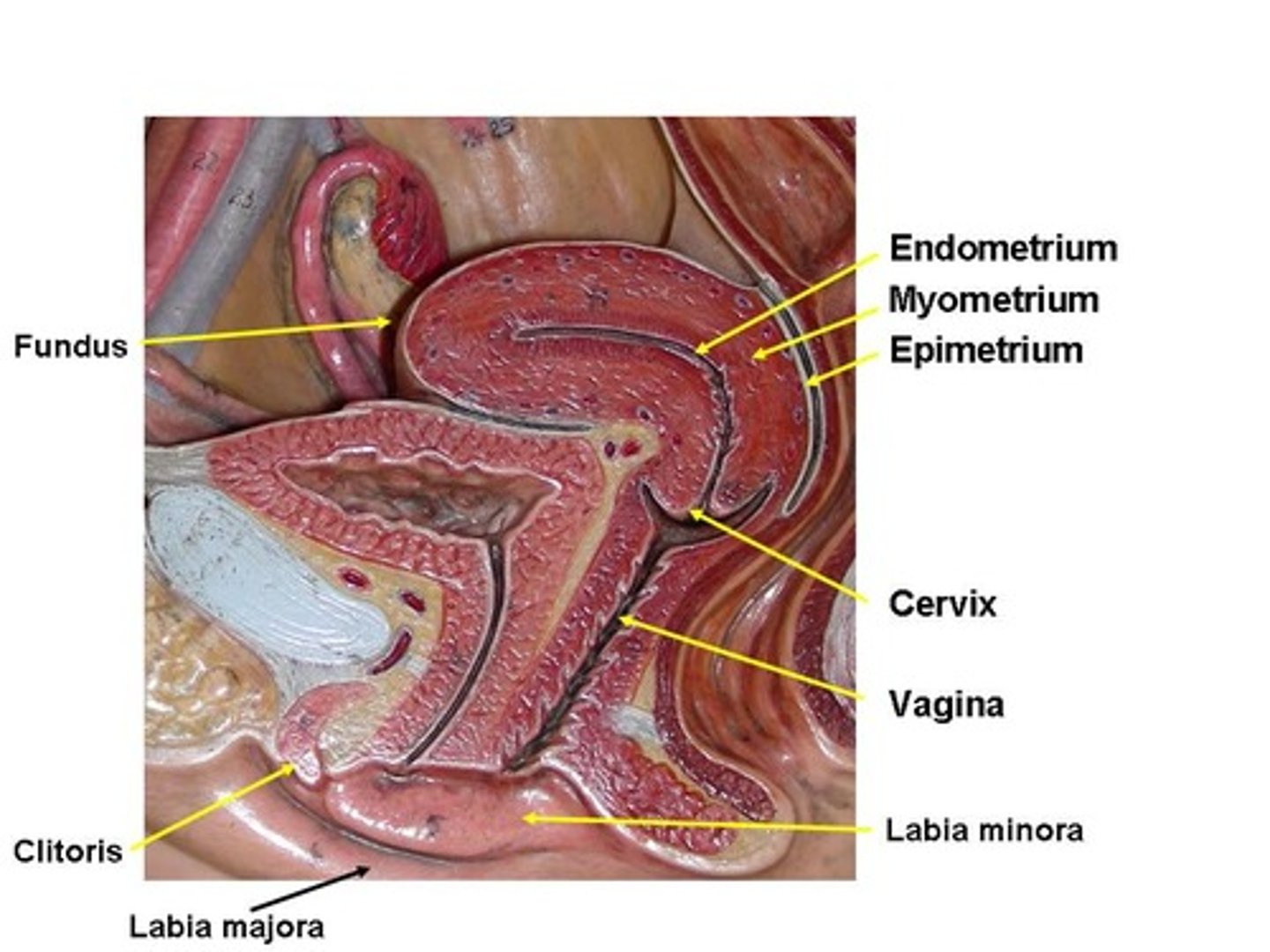 <p>erectile tissue, superior to orifice of urethra</p>