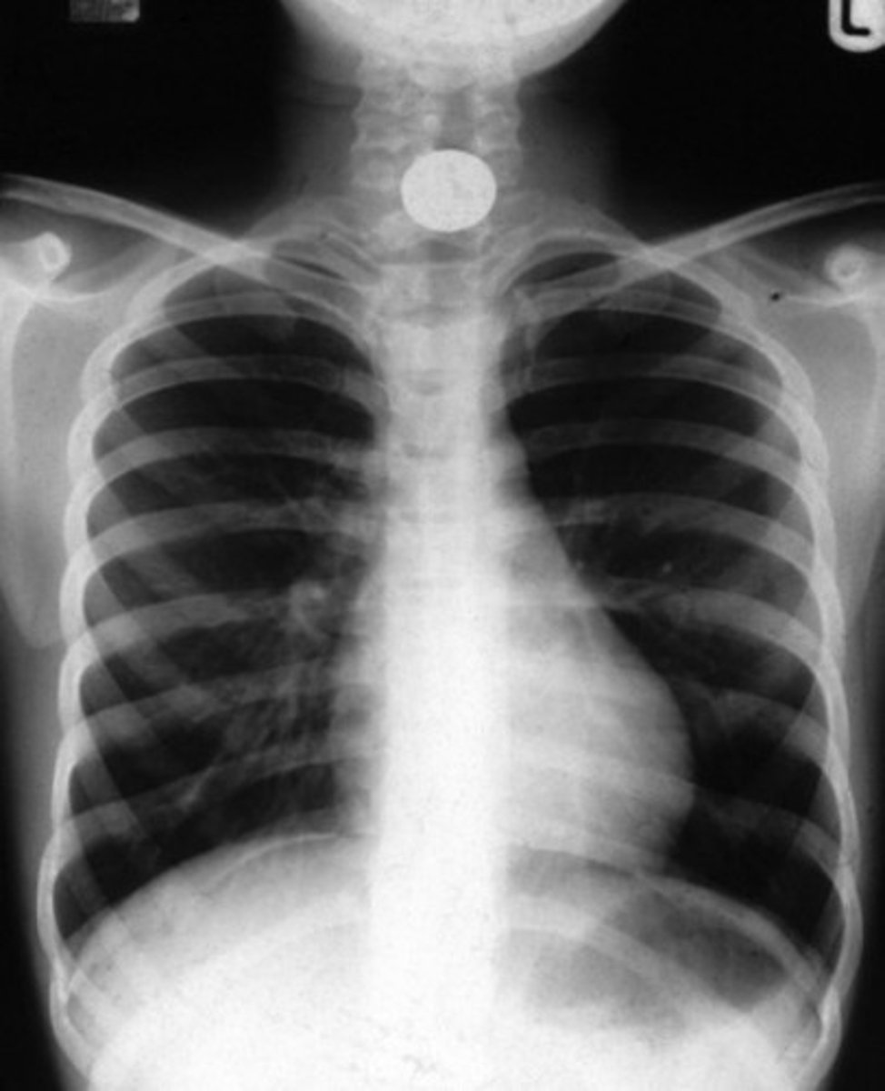 <p>- usually plain film x-rays.</p>