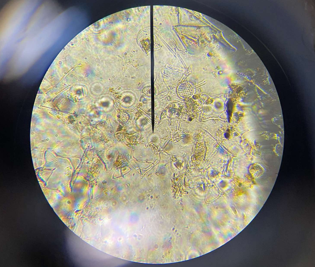 <p>primarily unicellular; cells walls are made of silica; can be found in both freshwater and marine habitats; two basic types: centric (radially symmetrical) and pinnate (bilaterally symmetrical); diatomaceous earth</p>