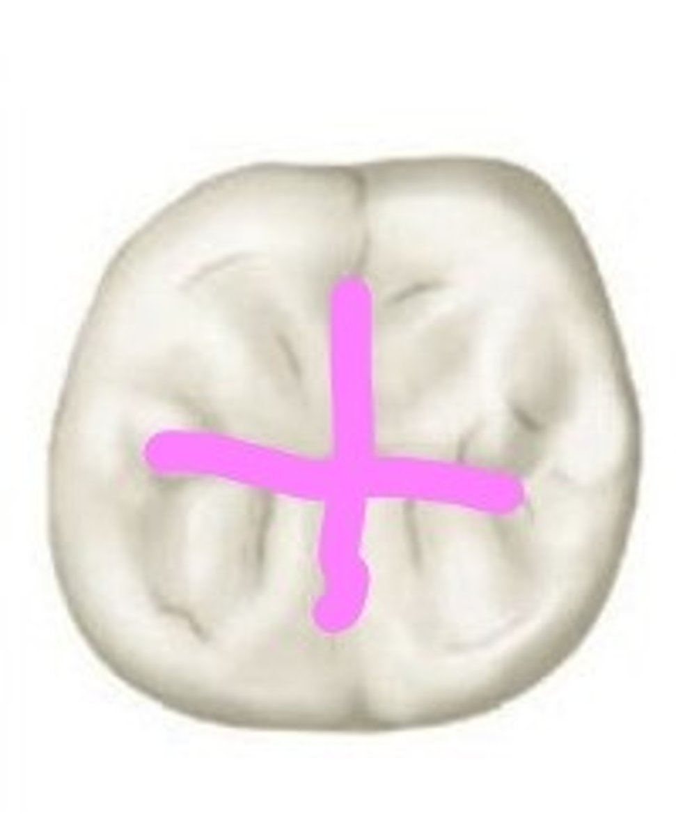 <p>Mandibular second permanent molar.</p>