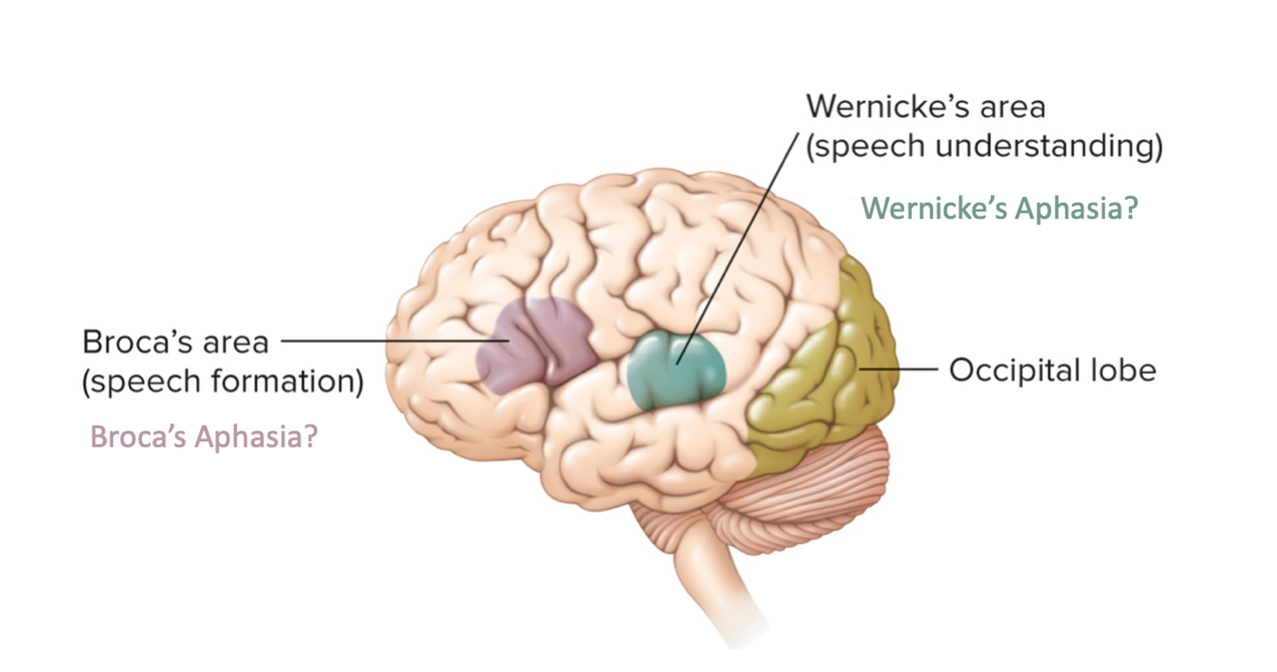 <p>wernicke’s aphasia</p>