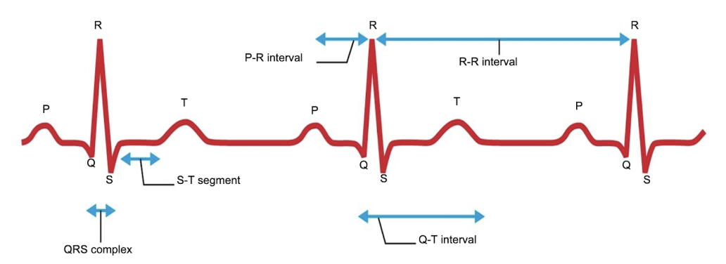 <p>which wave demonstrates the atria depolarizing?</p>
