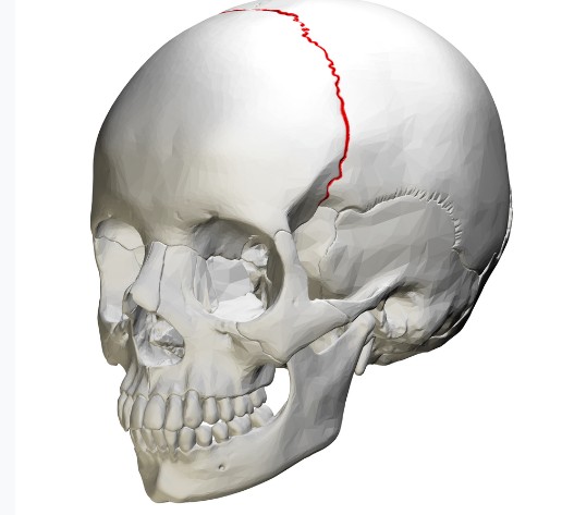 <p>What type of suture is this?</p>