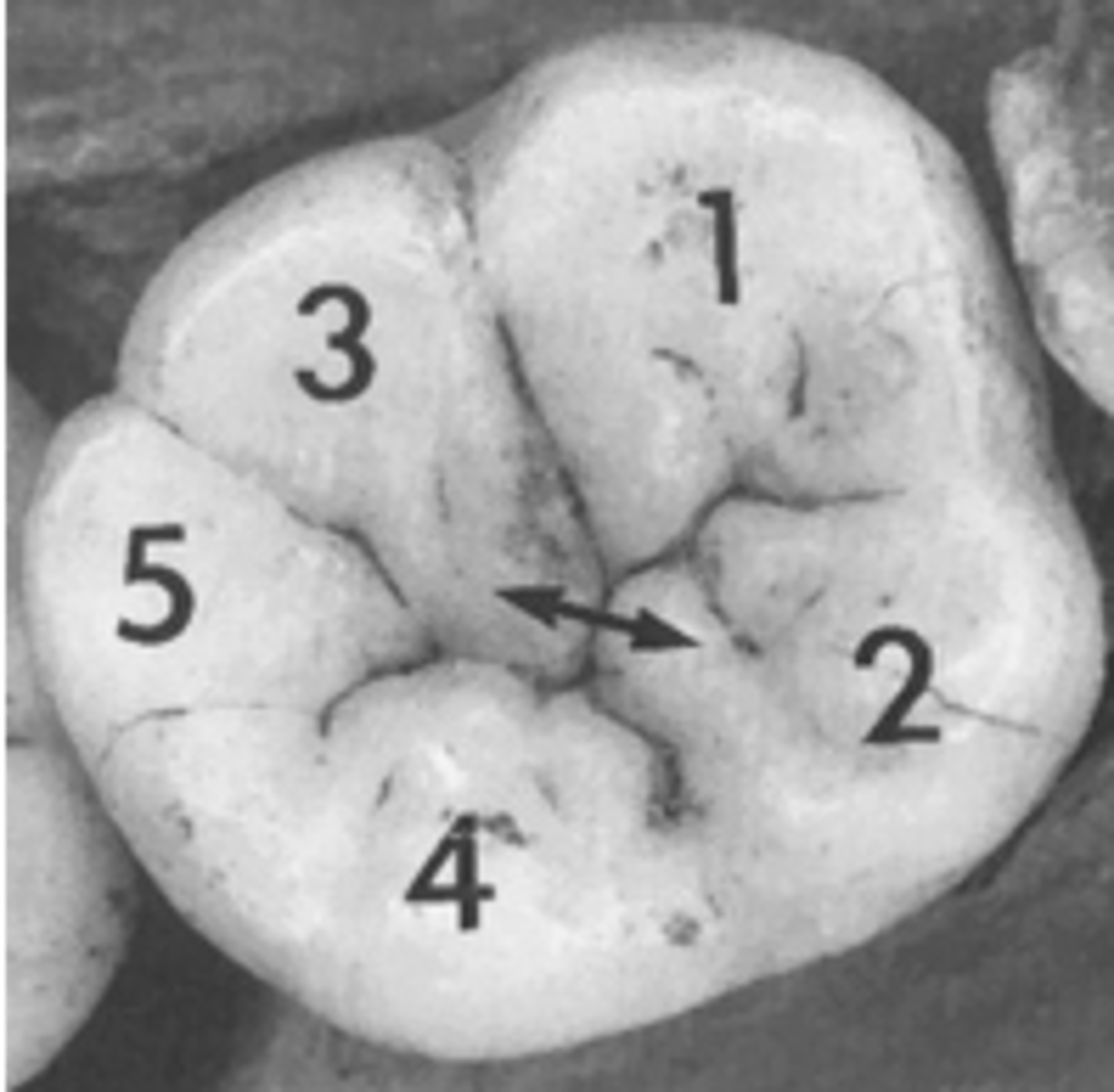 <p>Y-5 molar patterns</p>