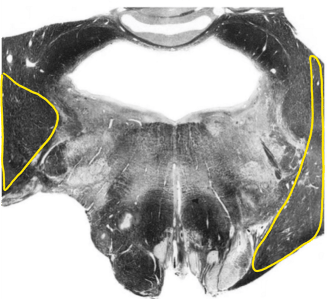 <p>ID the structure</p>