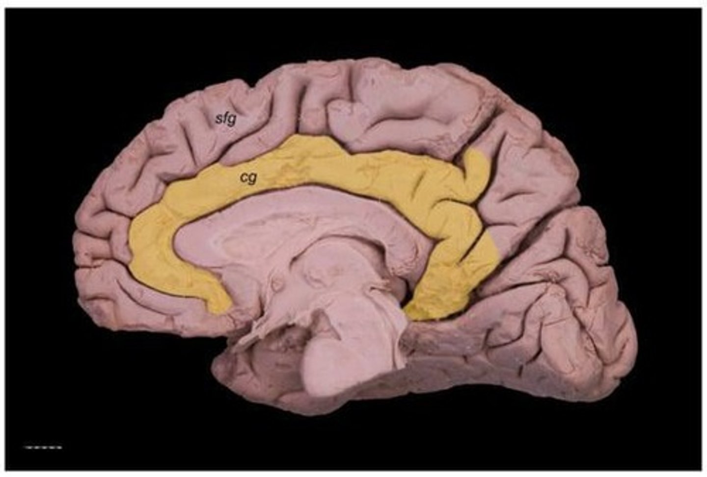 <p>Divides superior frontal gyrus from middle frontal gyrus.</p>