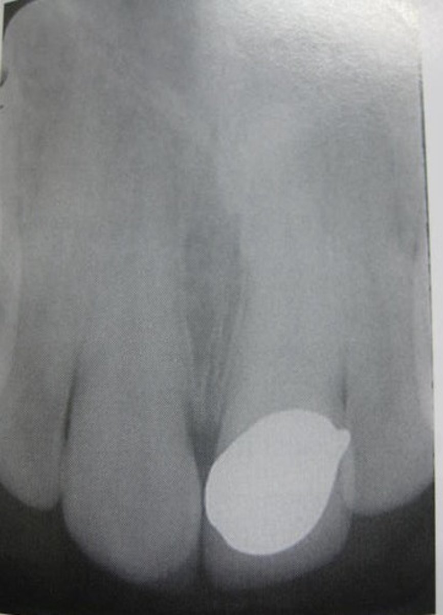 <p>Identify restoration type</p>