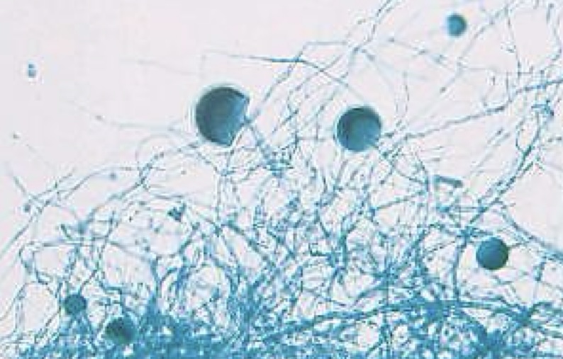 <p>Identify: Fungi</p>