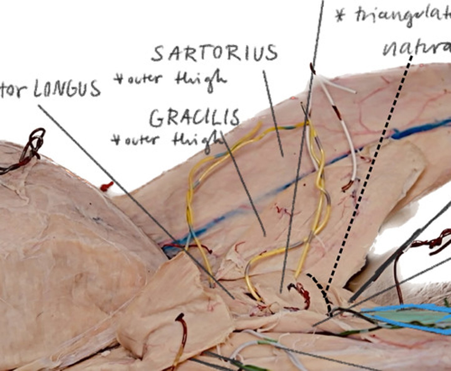 <p>Most medial leg flap</p>