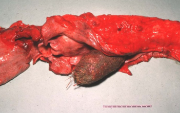 <p>What is this condition?</p>