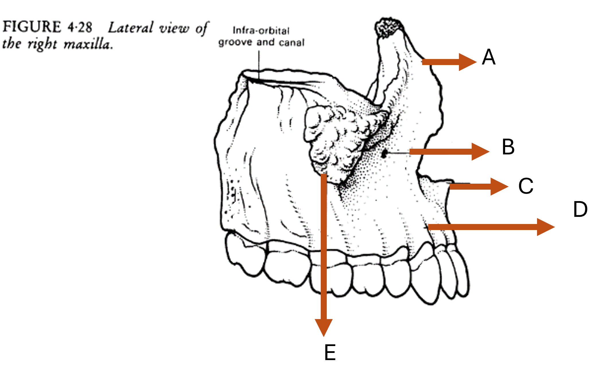 term image