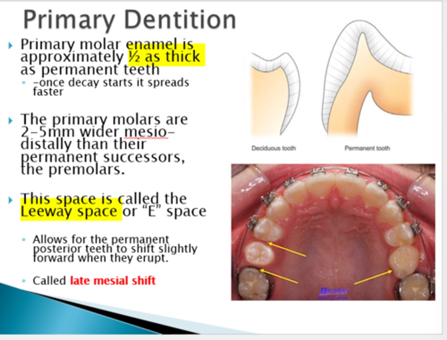 <p>Leeway space or "E" space</p><p>(allows permanent teeth to come in straighter)</p>