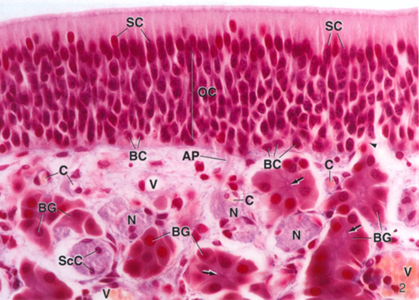 <p>ID the type of epithelium:</p>
