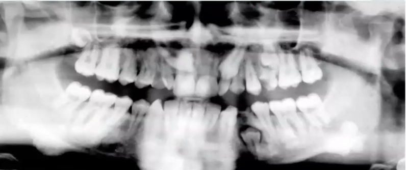 <p>what is the diagnsis?</p>