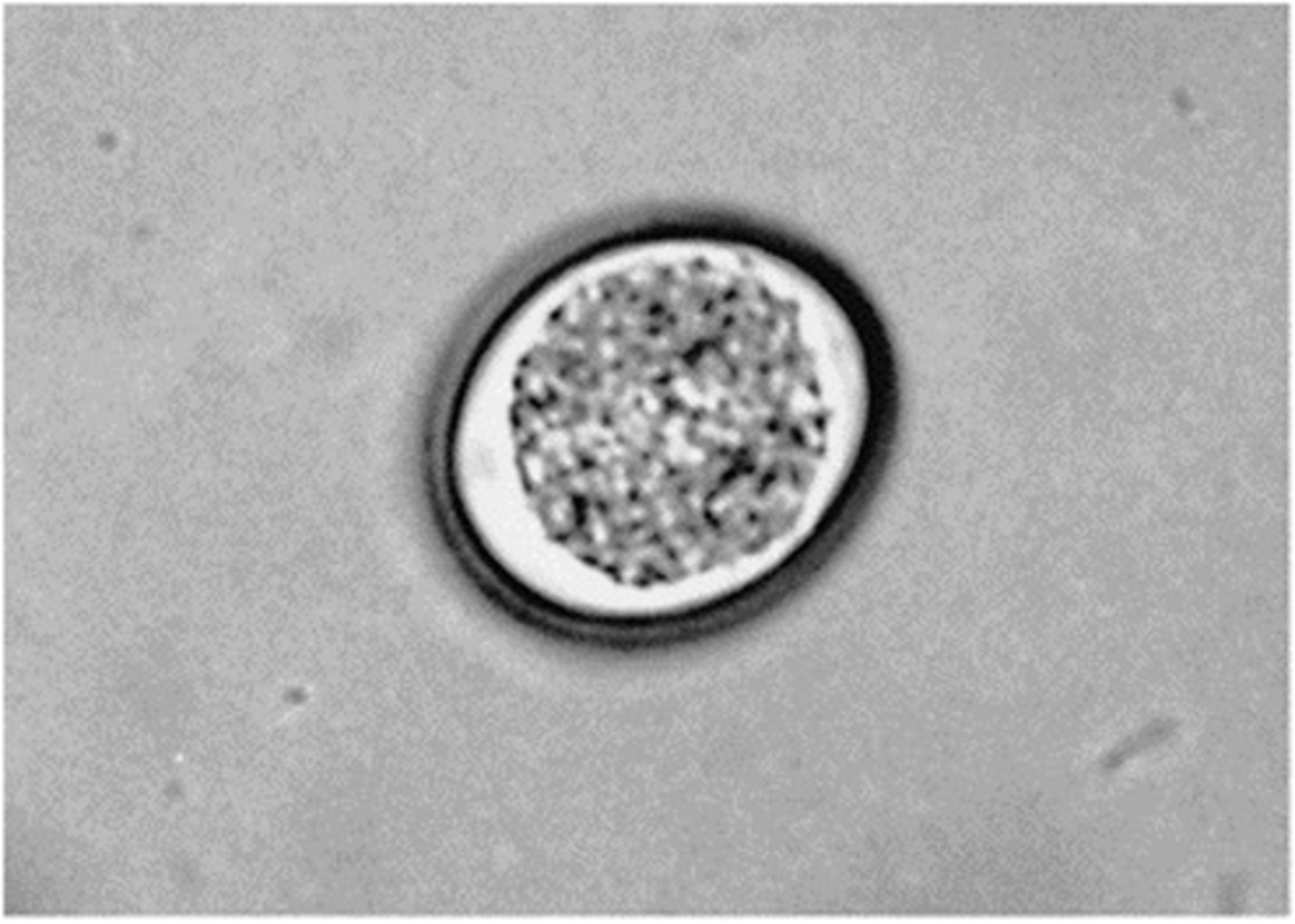 <p>This coccidian of pigs is identified as:</p>
