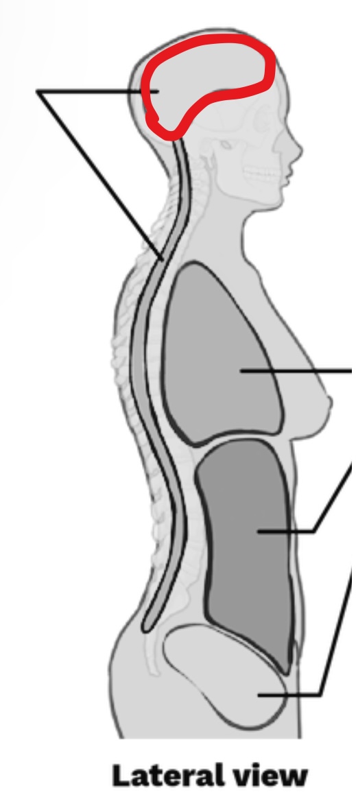 <p>What Cavity is this?</p>