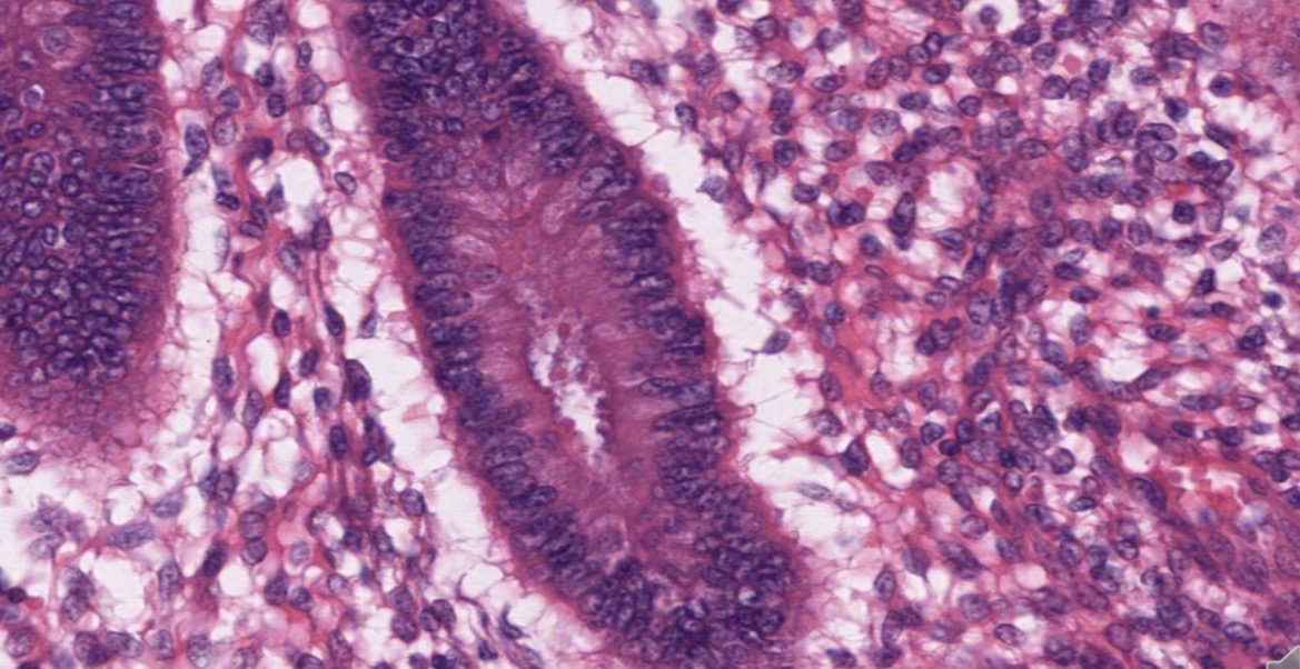 <p>Epitelio pseudoestratificado cilíndrico útero endometrio</p>