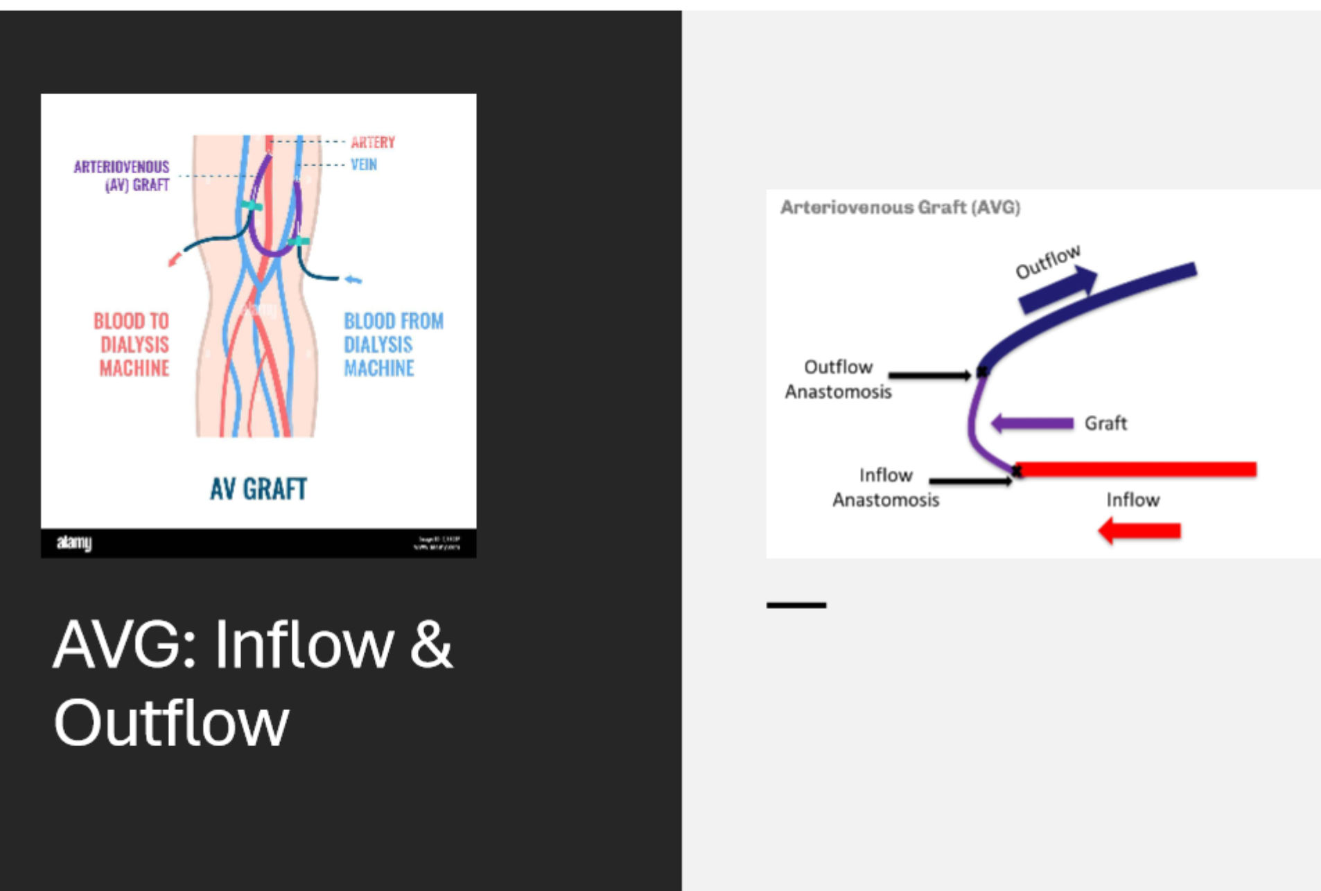 <p>from the arterial inflow</p>