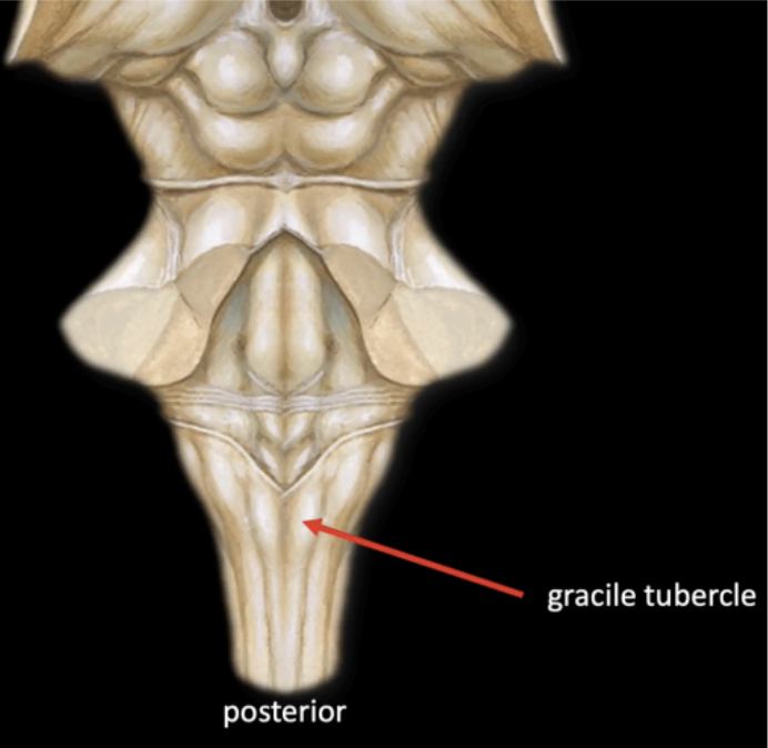 <p>Gracile Tubercle</p>