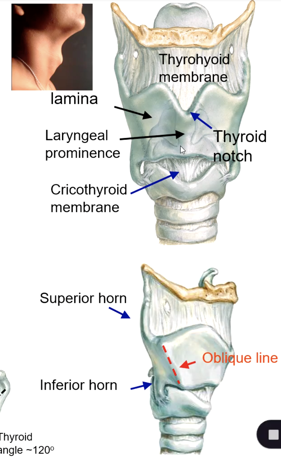<p>what 3 muscles attach to the oblique line of thyroid cartilage?</p>