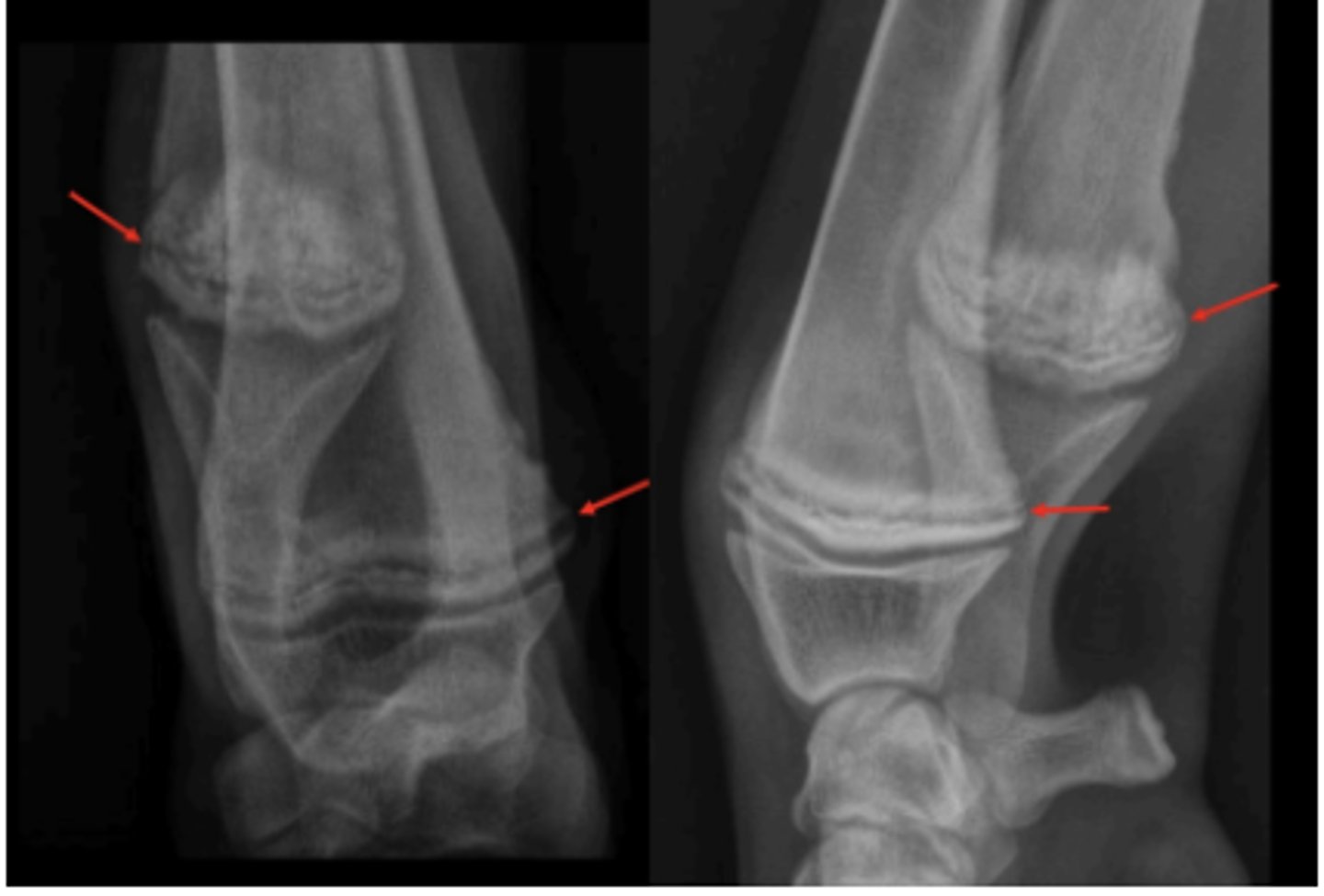 <p>6 month old Lab with distal limb swelling and the metaphysis is warm to the touch.- What is wrong with it?</p>