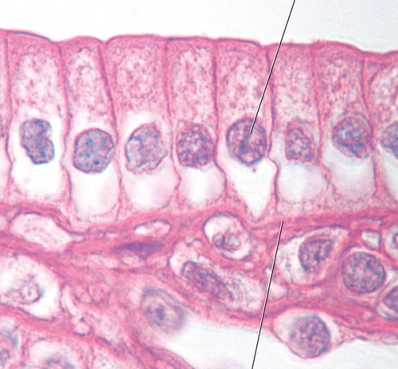 <p>column shaped cells</p>