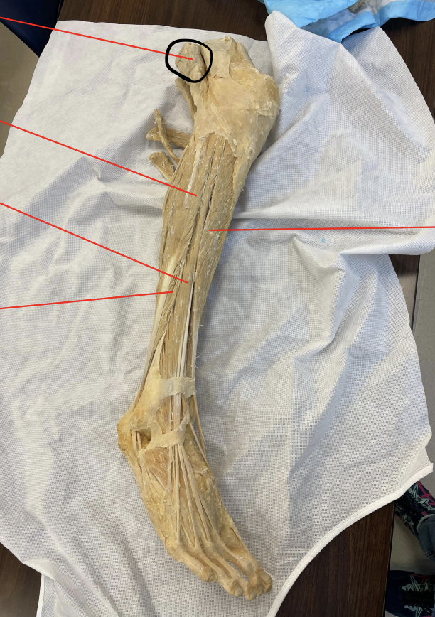 <p>identify + state origin, insertion, action, innervation of marked structure</p>