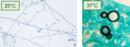 <p>A <strong>dimorphic fungus</strong> that forms <strong>septate hyphae</strong> at 25°C and <strong>broad-based budding yeast</strong> at 37°C.</p>