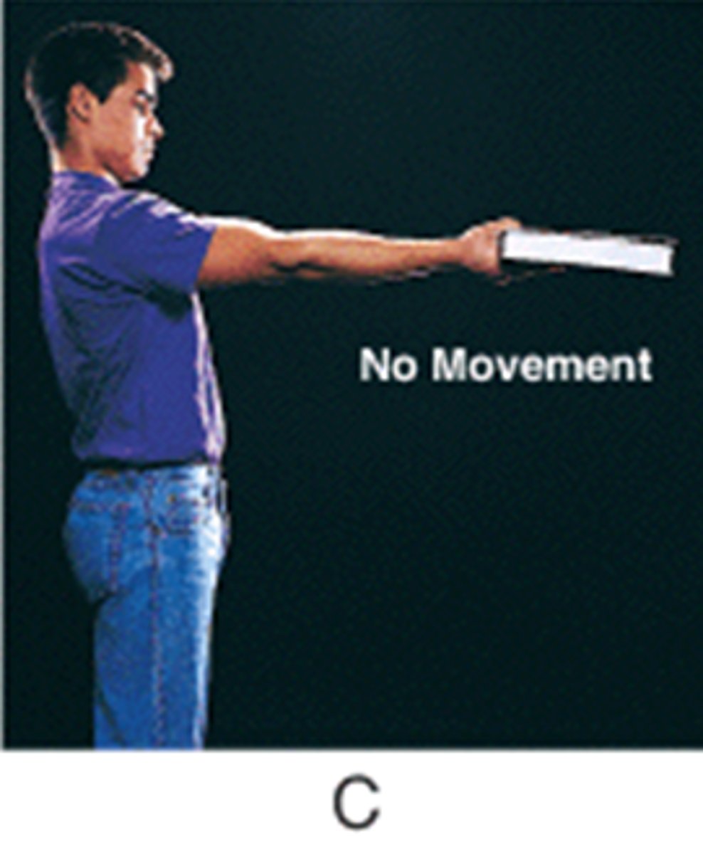 <p>same length, joint doesn't move, develops tension (gravity)</p>