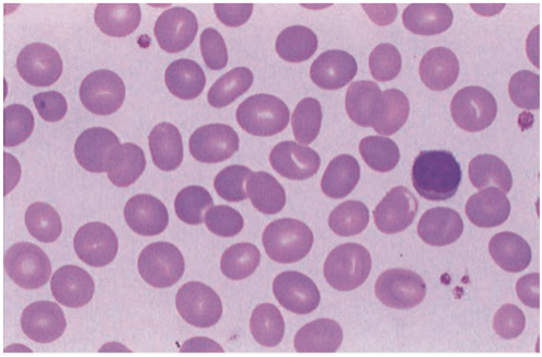 <p><span style="font-family: Corbel, sans-serif"><strong>B Cells </strong></span></p>