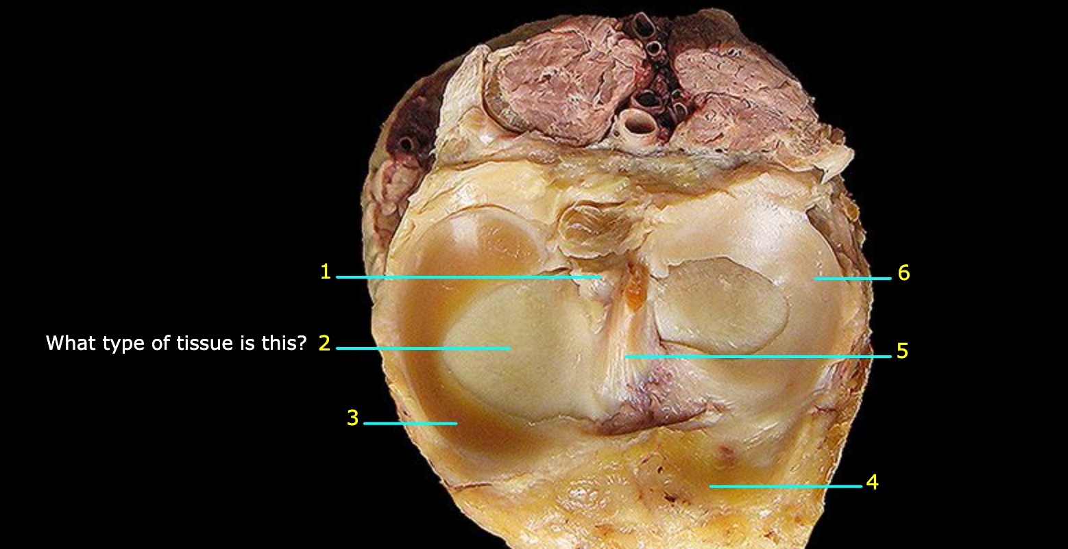 <p>What structure is labeled 6?</p>