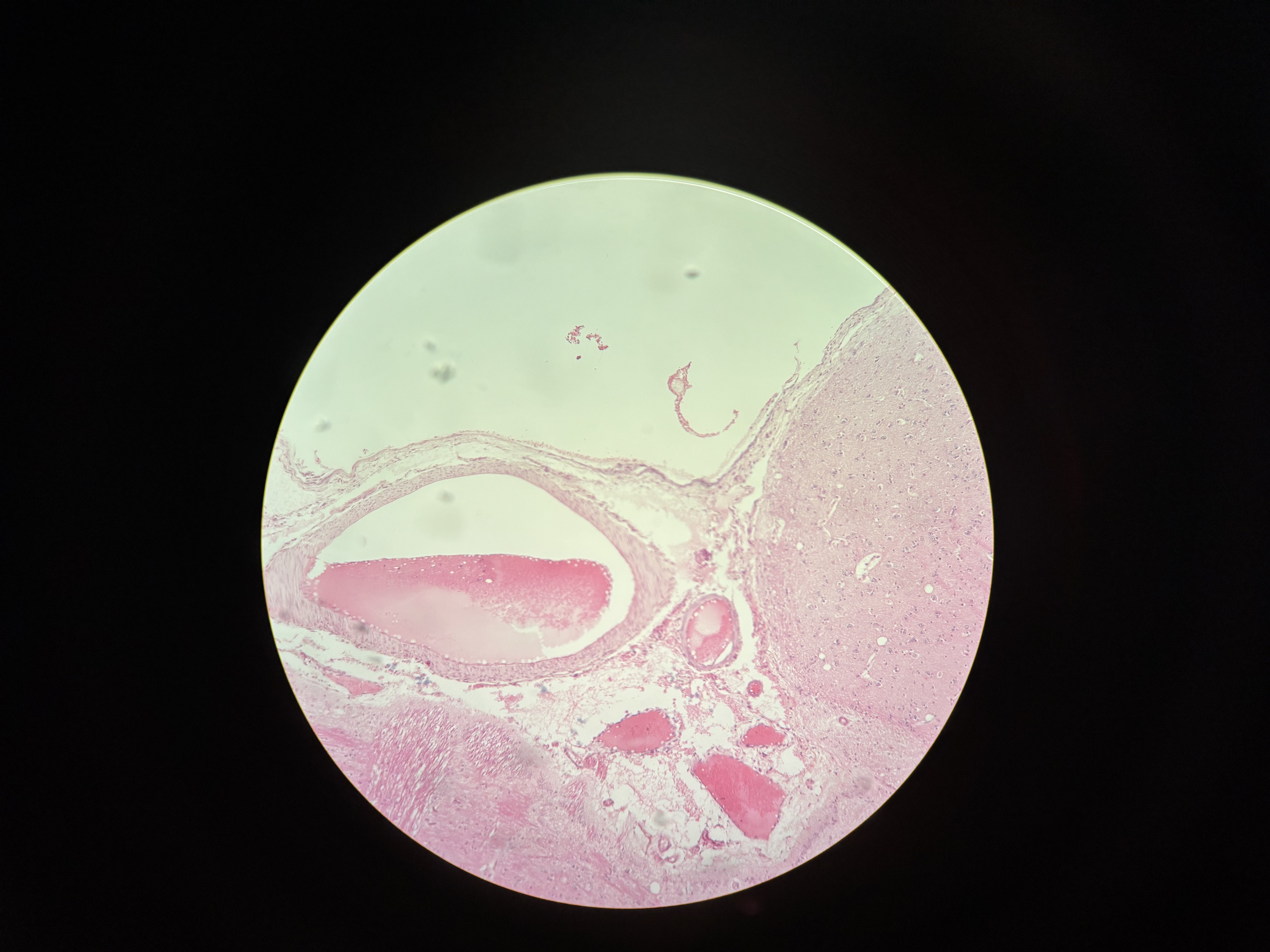 term image