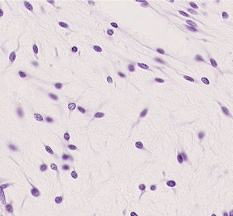 <p>What type of tissue is shown here?</p>