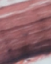 <p>Which type of tissue does this image depict?</p>