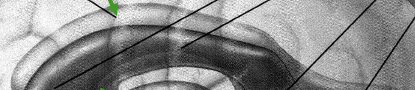 <p>paired; located in all parts of the cerebral cortex </p>