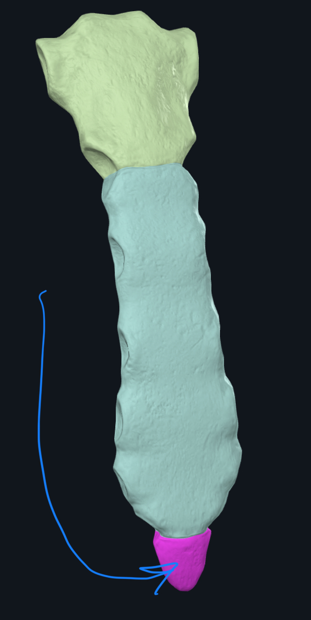 <p>What is this?</p>