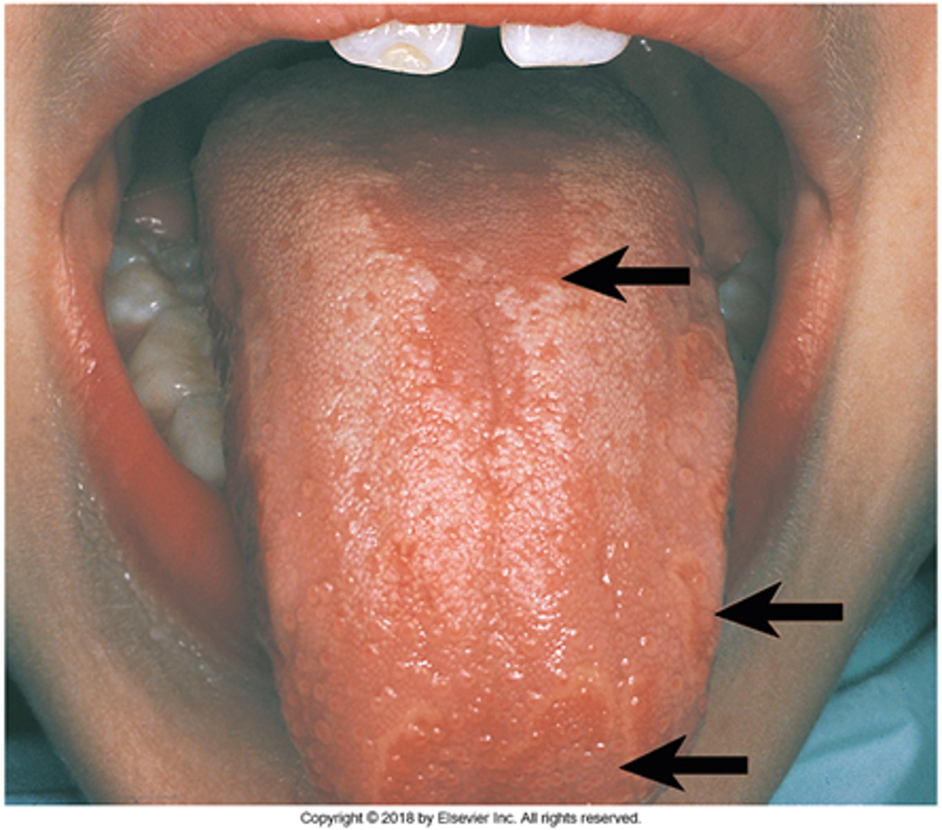 knowt flashcard image