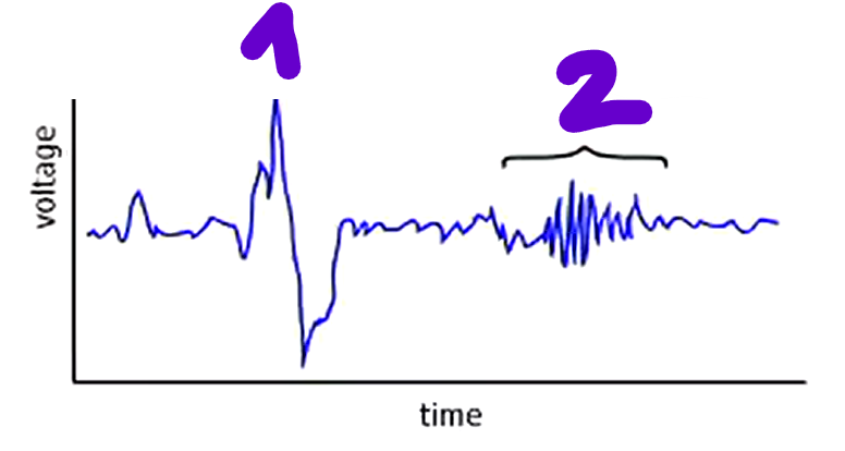 <p>What are 1 and 2 on this graph, depicting EEG activity during non-REM sleep? What do they show?</p>