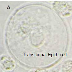 <p>Transitional Epithelial Cell</p>