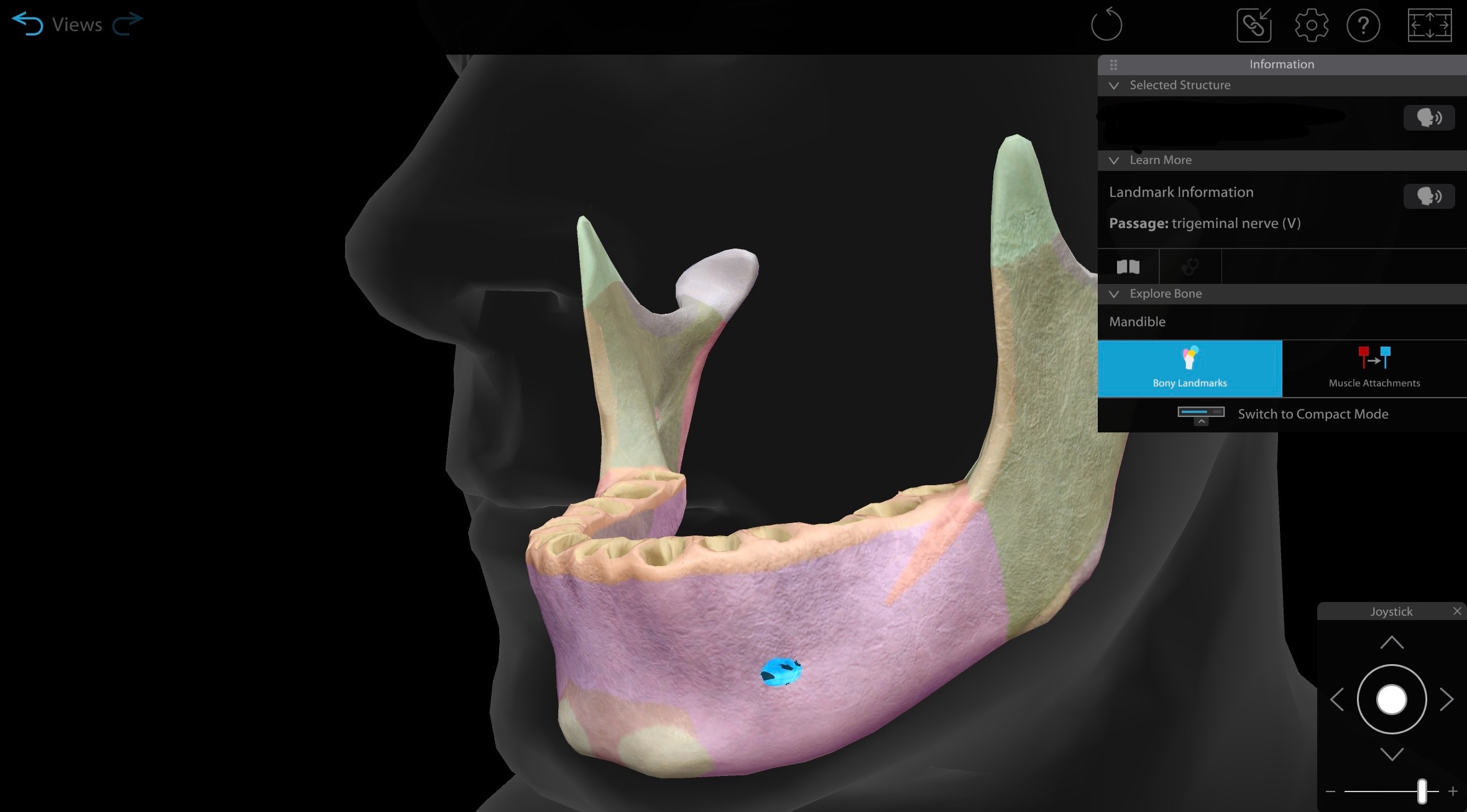 <p>Mental foramen of the mandible bone, L</p>