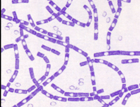 <p>B. anthracis morph &amp; how to r/o?</p>