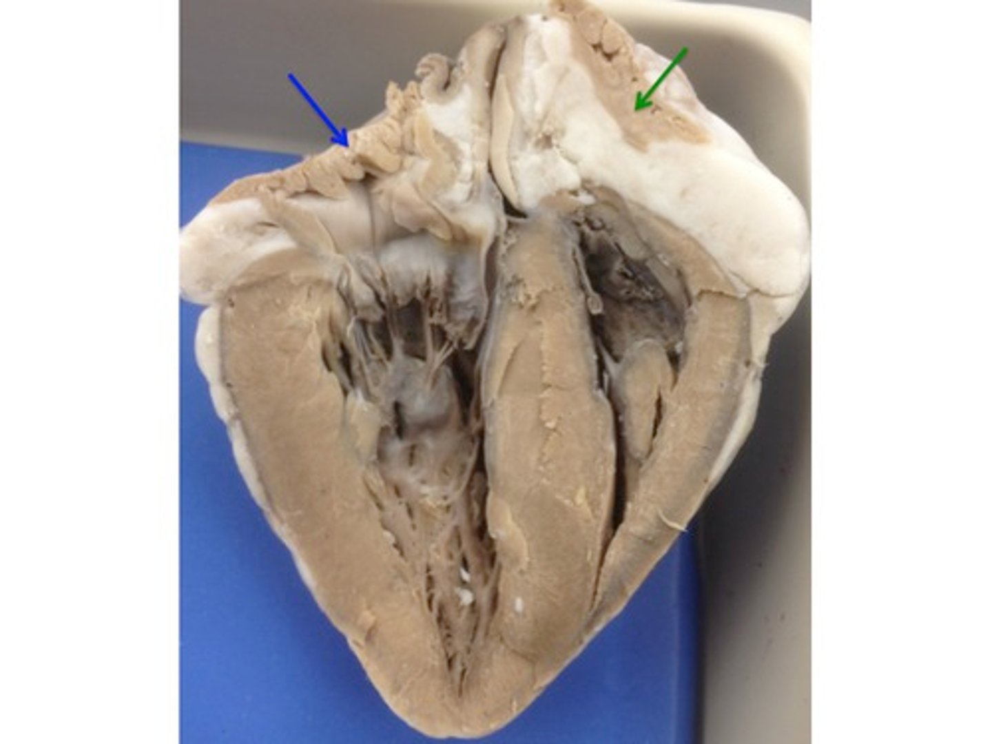 <p>What is the brown shriveled structure the GREEN arrow is pointing to?</p>