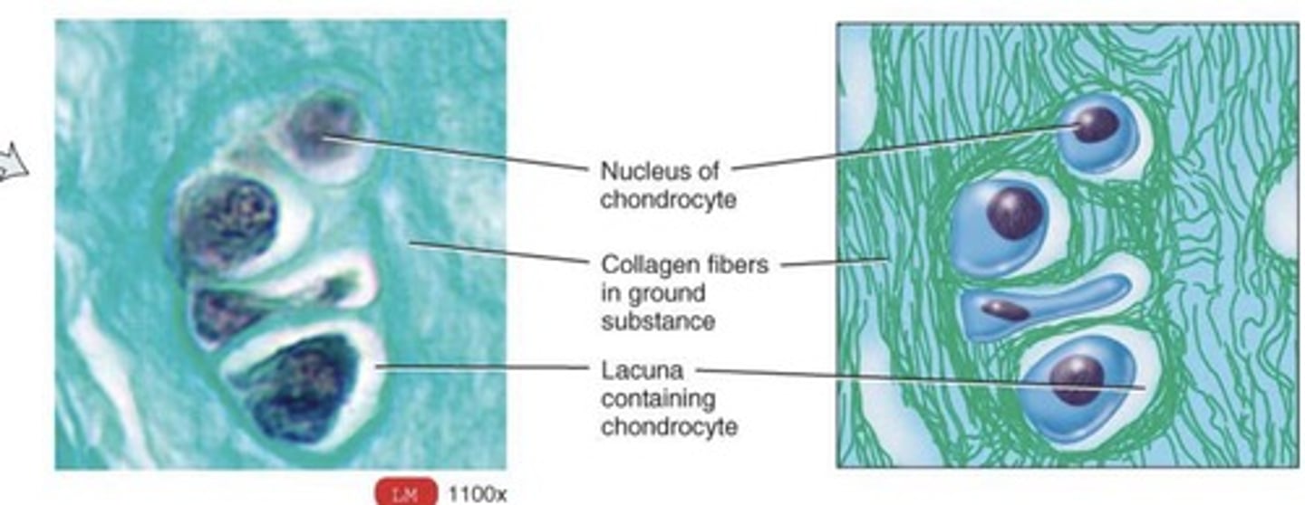 <p>What type of cartilage is this ?</p>