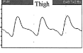 <ol><li><p>Sharp systolic peak</p></li><li><p>Prominent dicrotic notch or reflected wave in late systole and early diastole </p></li></ol><p></p>