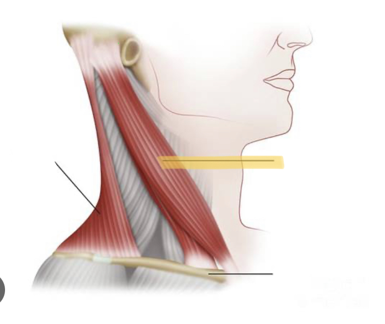 <p>Identify the highlighted muscle</p>