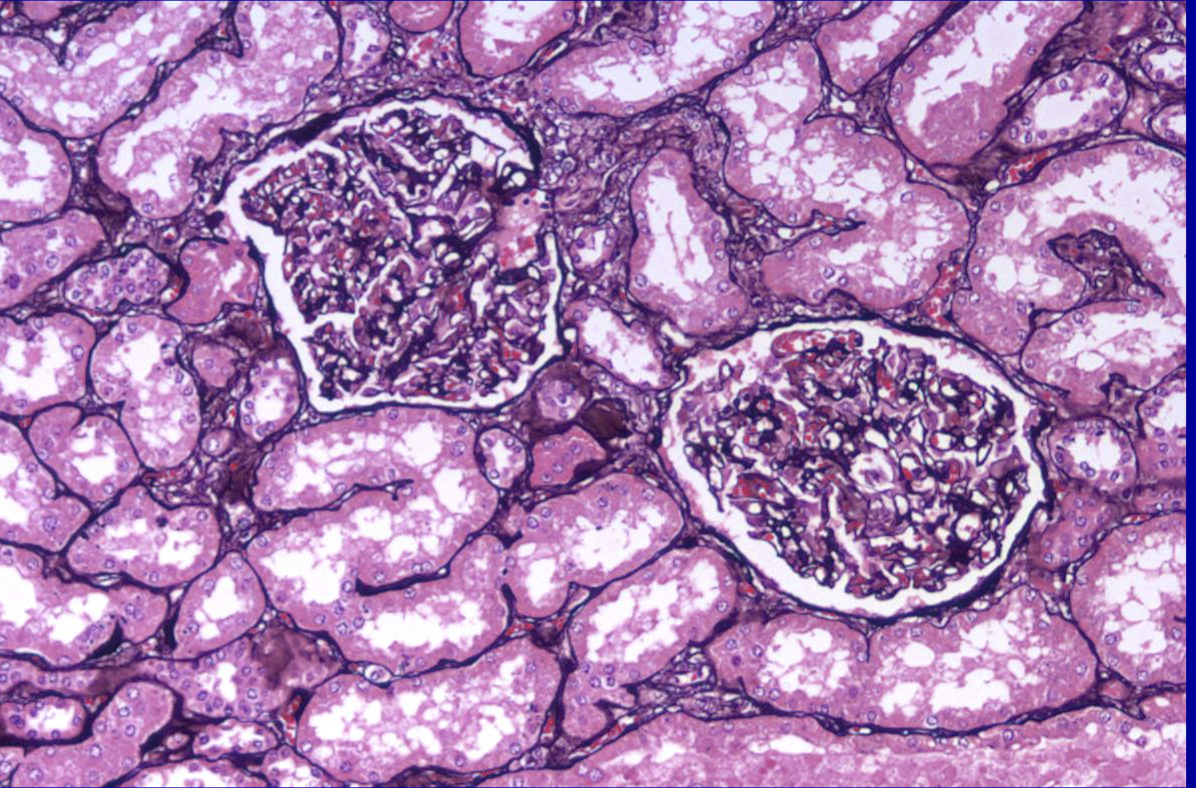 <p>ID the stain type </p>