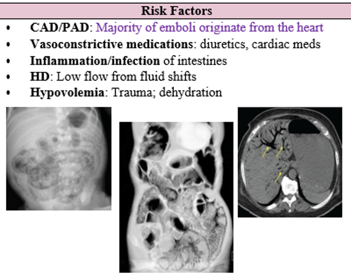 <p>Heart (CAD/PAD = risk factors) </p>
