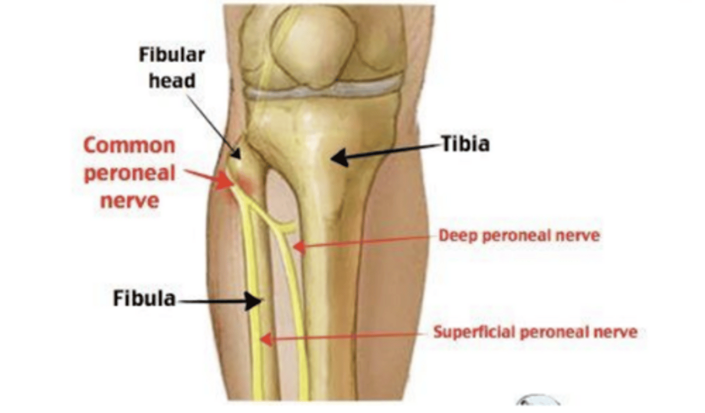 <p>Compression, trauma, Crossing legs, Rapid weight loss, Diabetes</p>