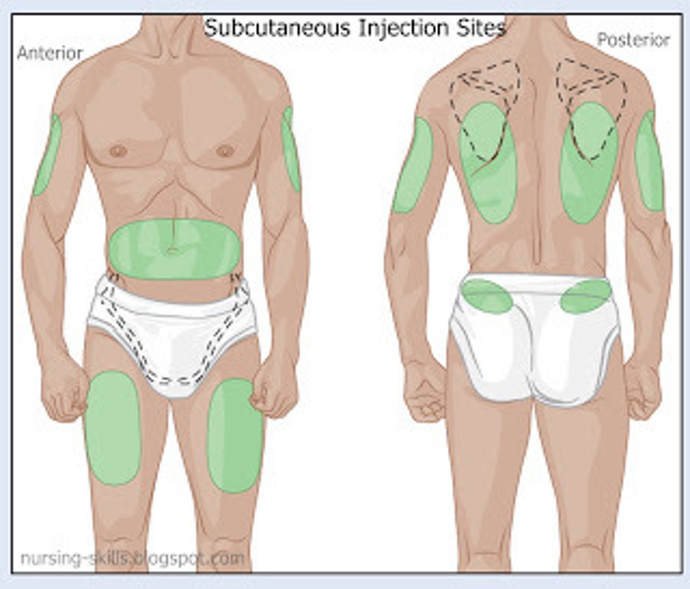 <p>abdomen, anterior thigh, flank, scapular, buttocks, outer aspect of the upper arm</p>