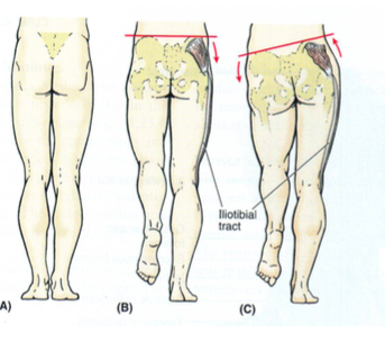 <p>If you observe a Trendelenburg gain pattern - pt is putting increased load on medial side of the knee therefore strengthening glute med may help with the medial knee pain</p>